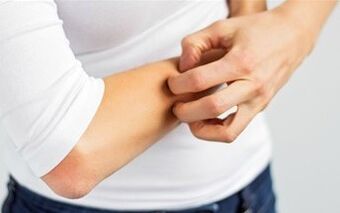 Itching can be called the first sign of the disease