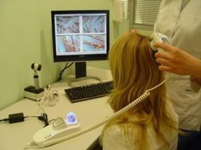 Diagnosis of psoriasis on the scalp
